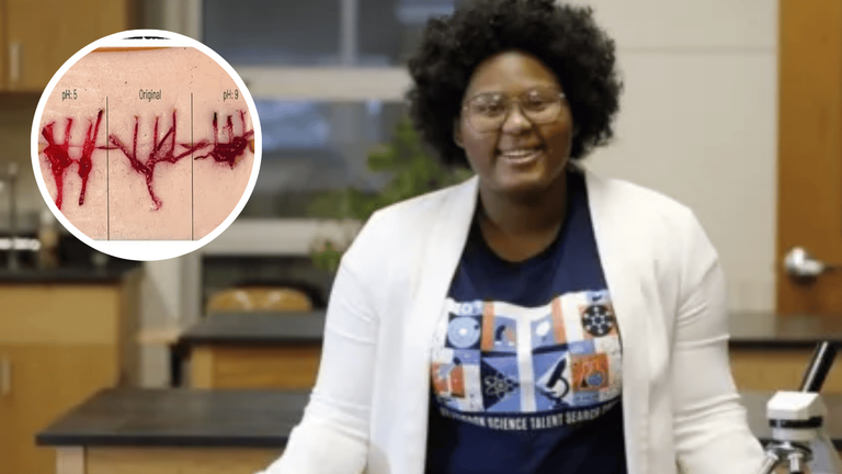 17-Year-Old’s Genius Sutures Change Color to Spot Infections