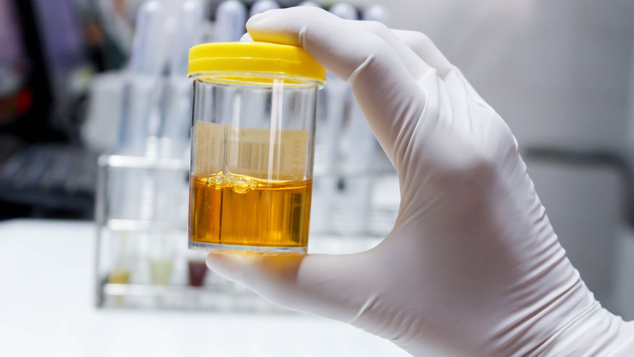 A Complete Guide to Choosing the Right Fake Urine Holder and Fake Pee for Sale
