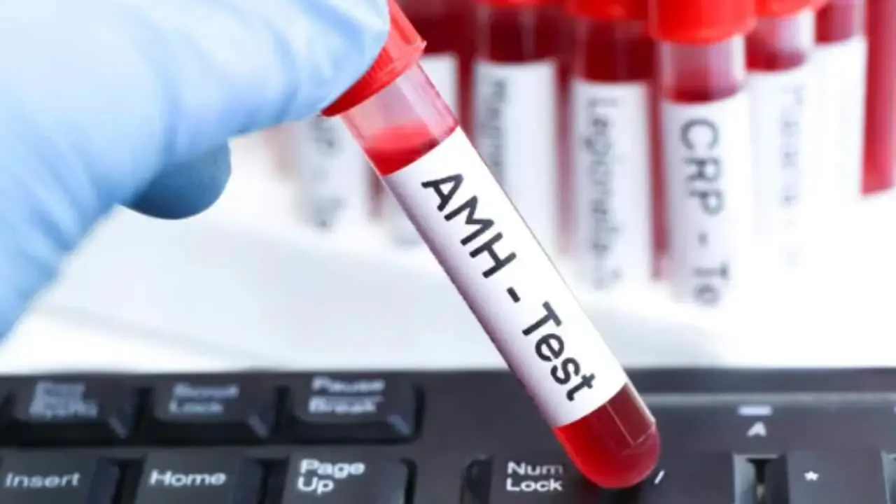 AMH test