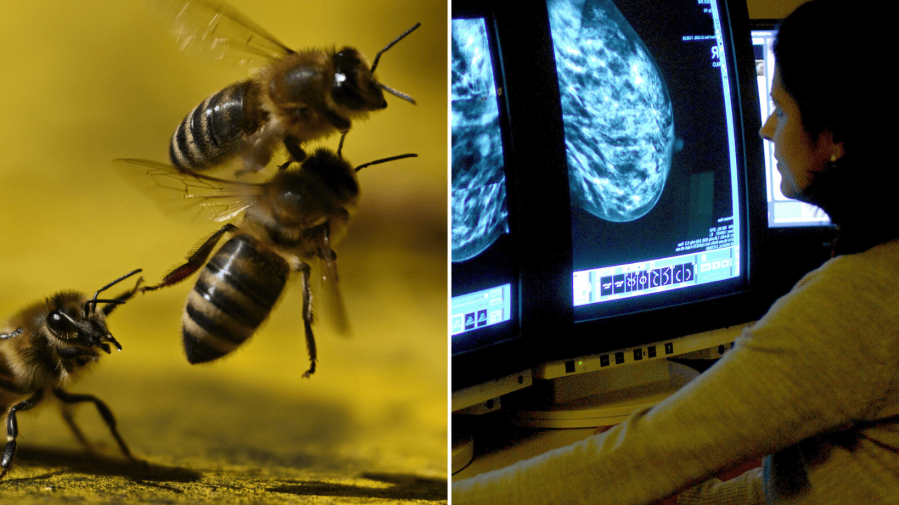 Bee Venom Kills Breast Cancer Cells in Under an Hour