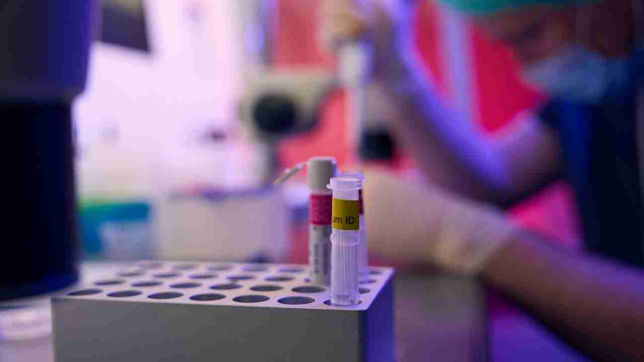 How Do Home Lab Tests Work in Dubai A Step by Step Explanation