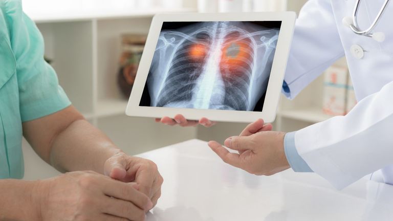 How to find the right pulmonologist for you