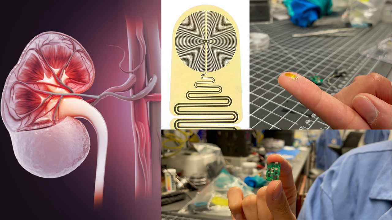 Researchers Found Device to Detect Organ Rejection After Transplant