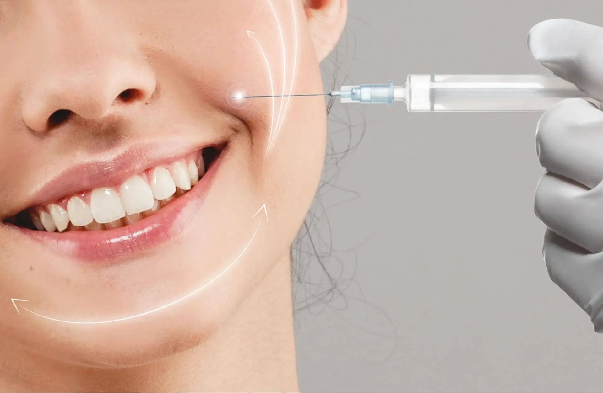 Restylane benefits
