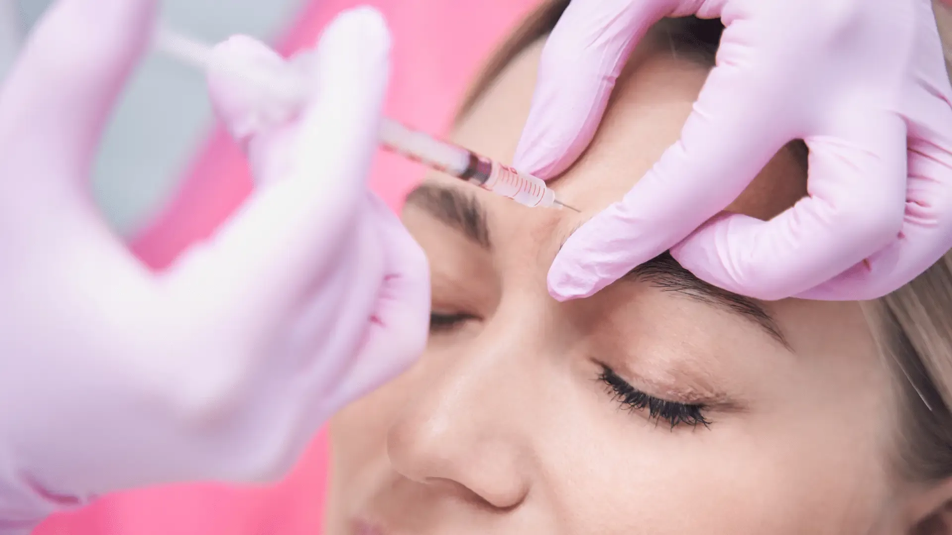 Restylane fillers