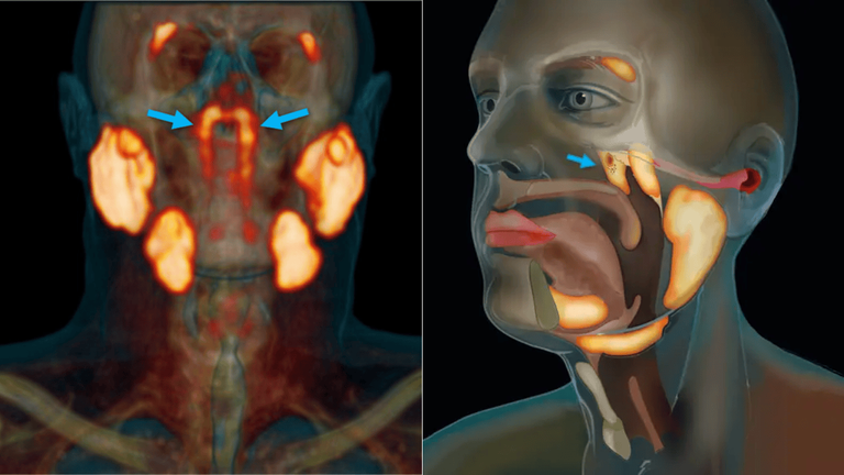 Scientists Just Found a Hidden Organ in the Human Head