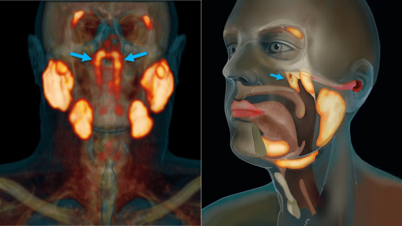 Scientists Just Found a Hidden Organ in the Human Head