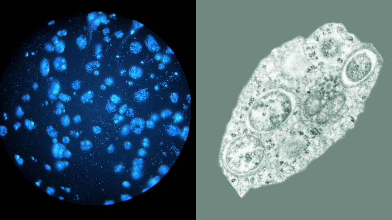 This bacteria turns mosquitoes against to deadly diseases