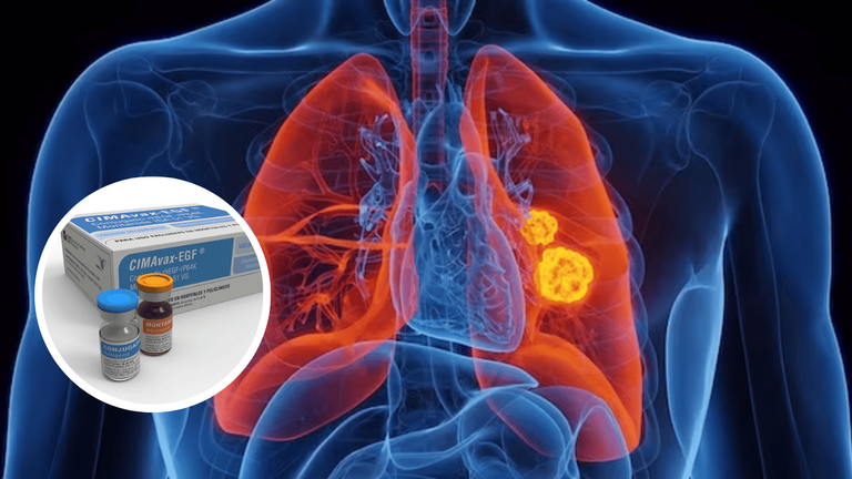 World’s First Lung Cancer Vaccine Could Save Millions