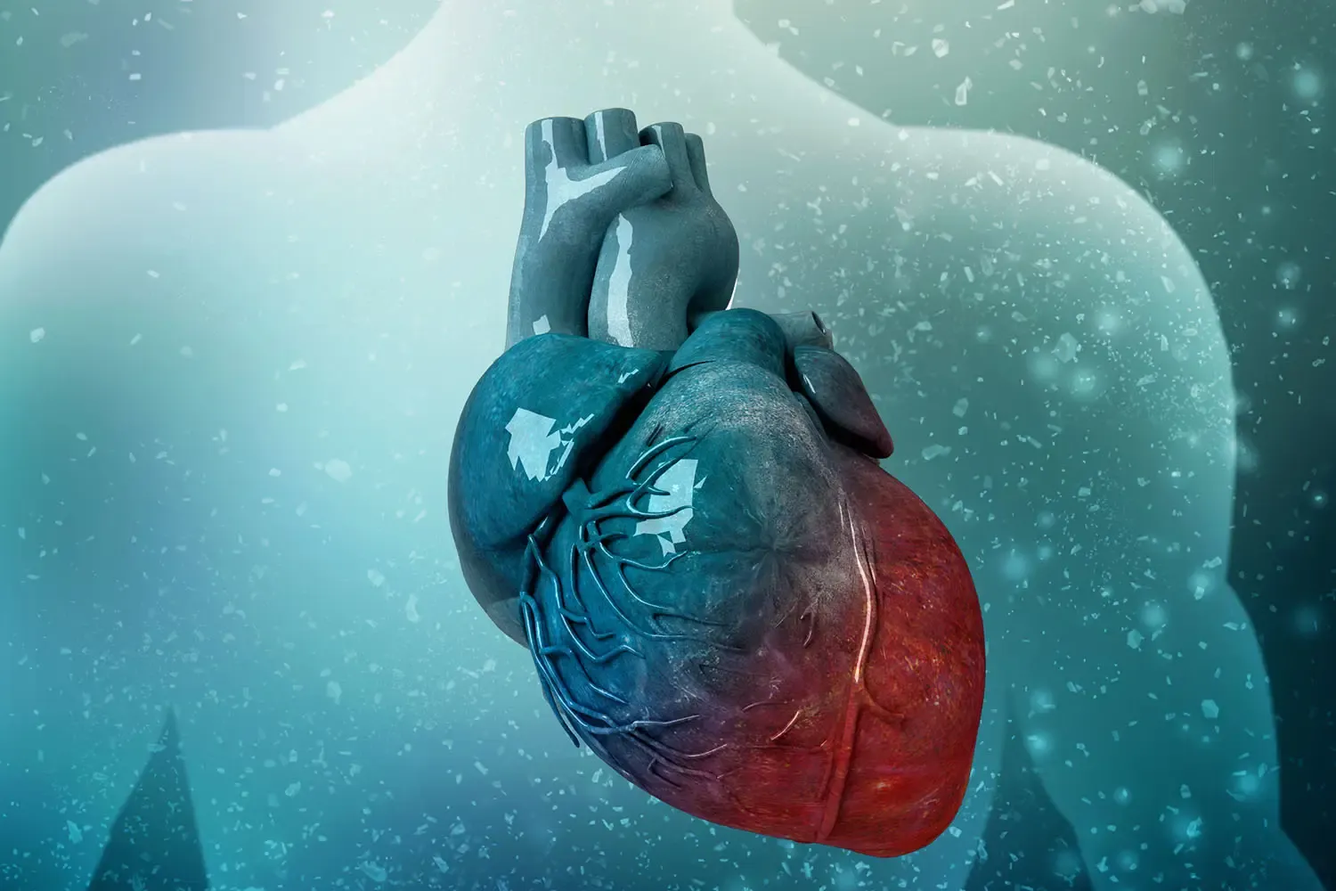 heart imaging