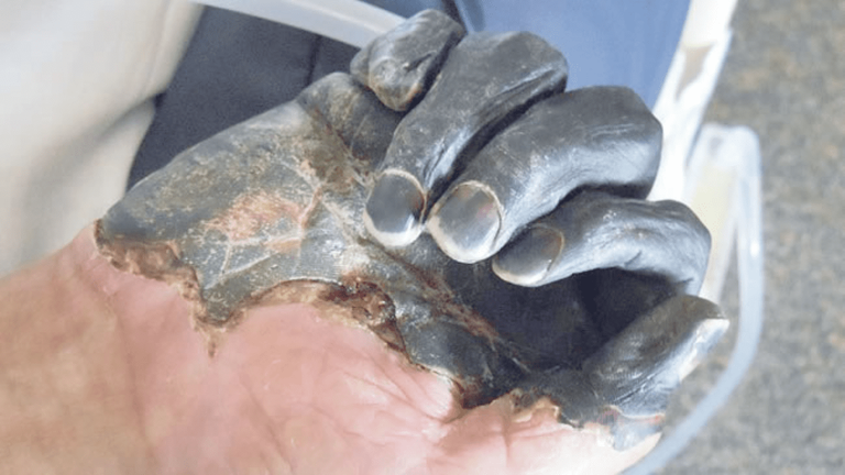 Plague Death in Archuleta County Prompts Health Officials to Issue Warning
